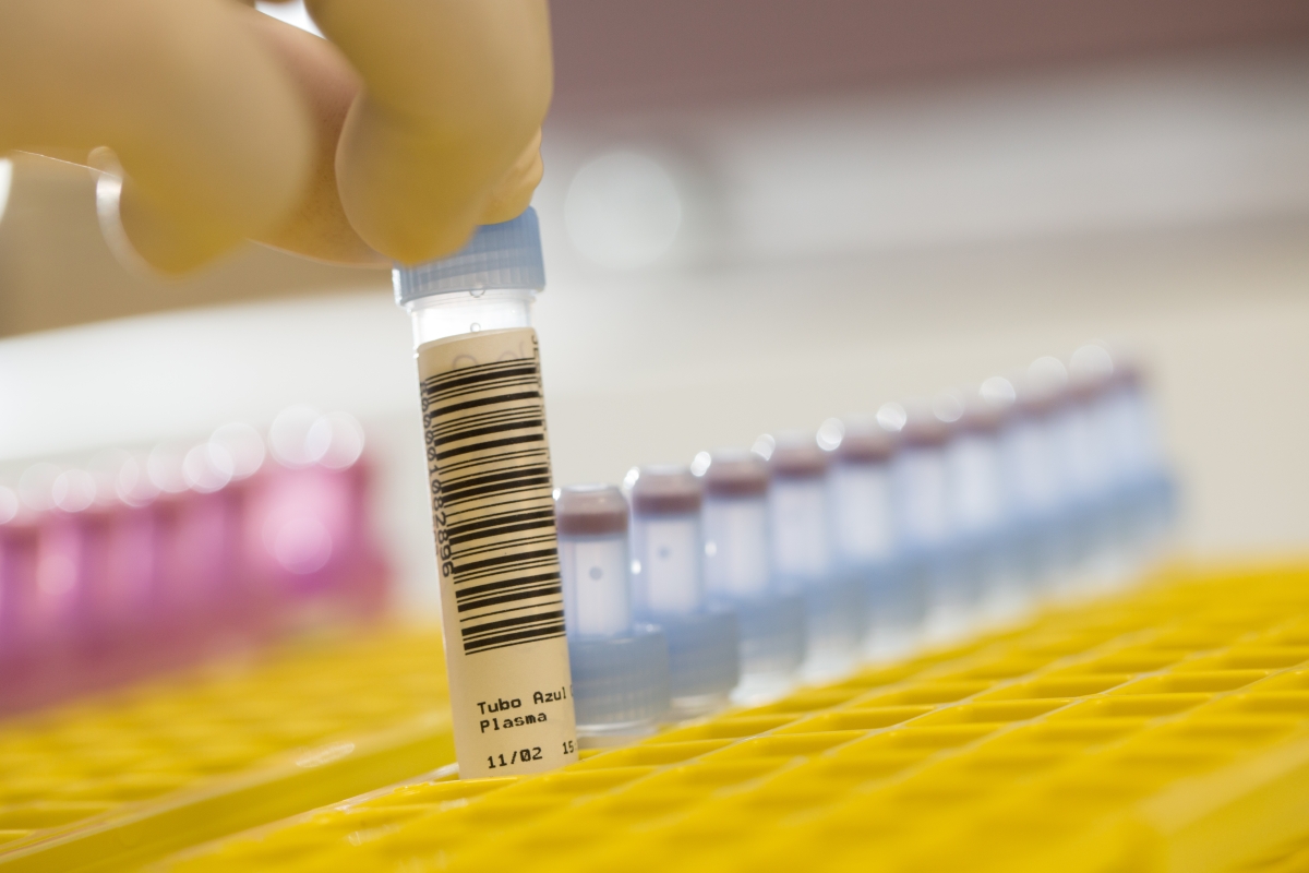 Ultra-X assume Laboratório de Análises Clínicas da Bene