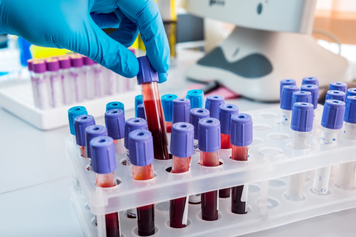 Exames laboratoriais: segurança e qualidade no Ultra-X