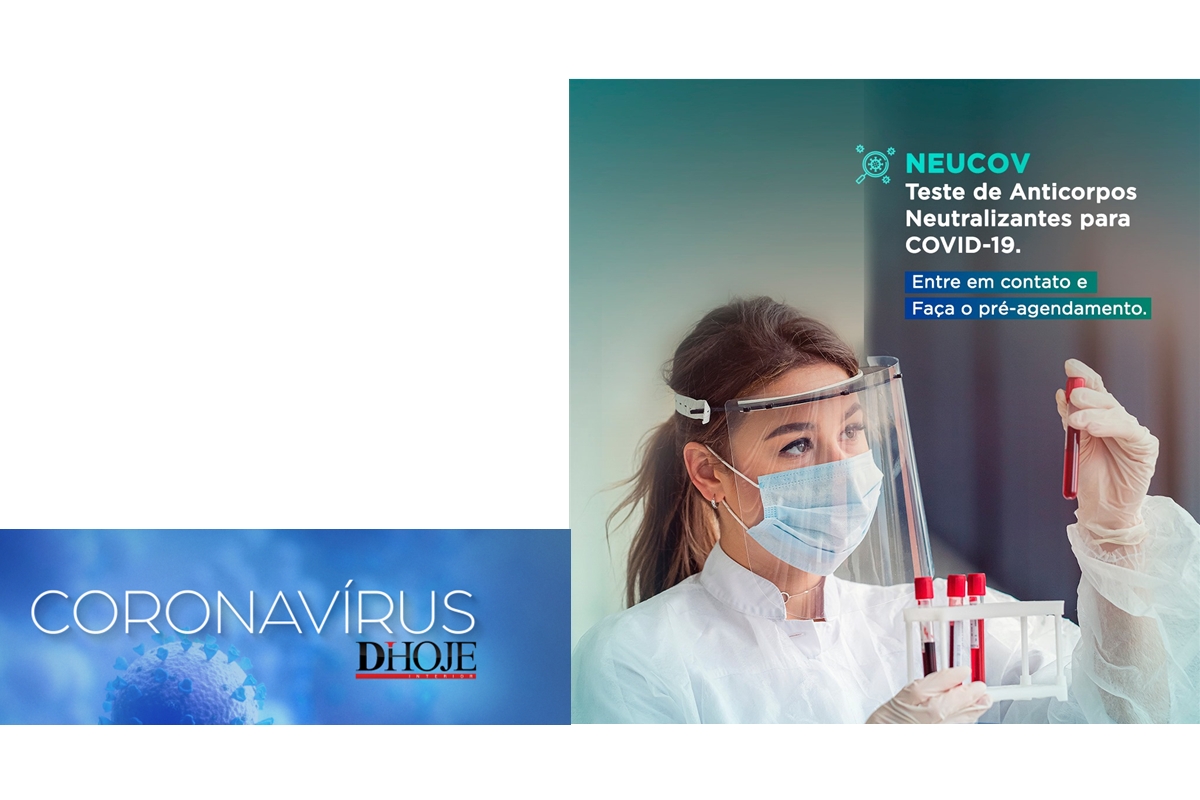 Novo teste mostra quem já pode estar imune à Covid-19