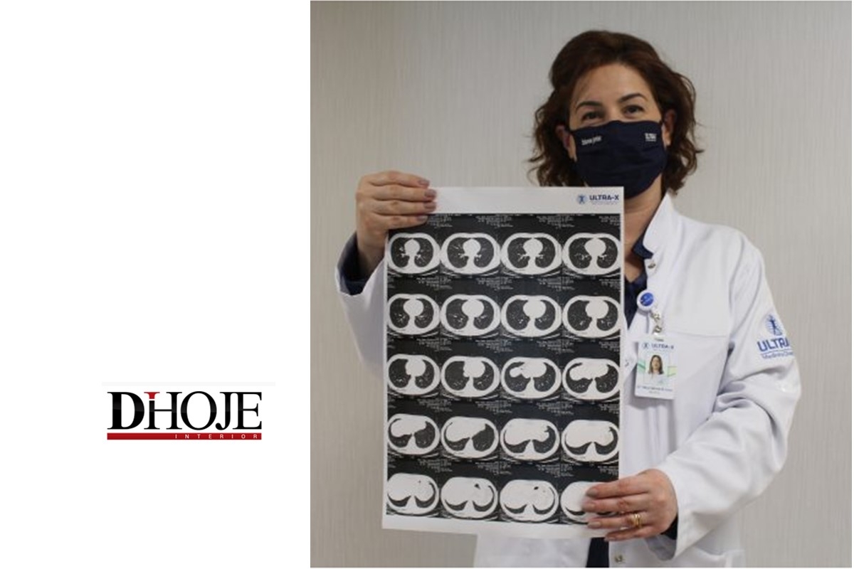 Cresce a procura por exames de check-up pós-Covid